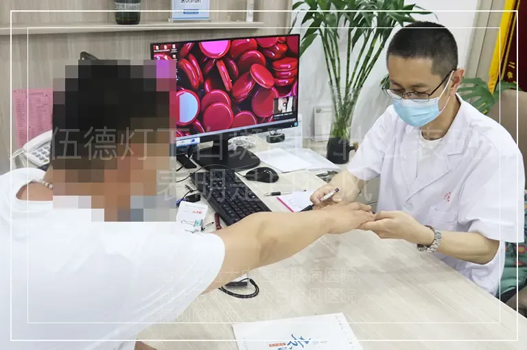 伍德灯下白斑图片什么表现表明是白癜风