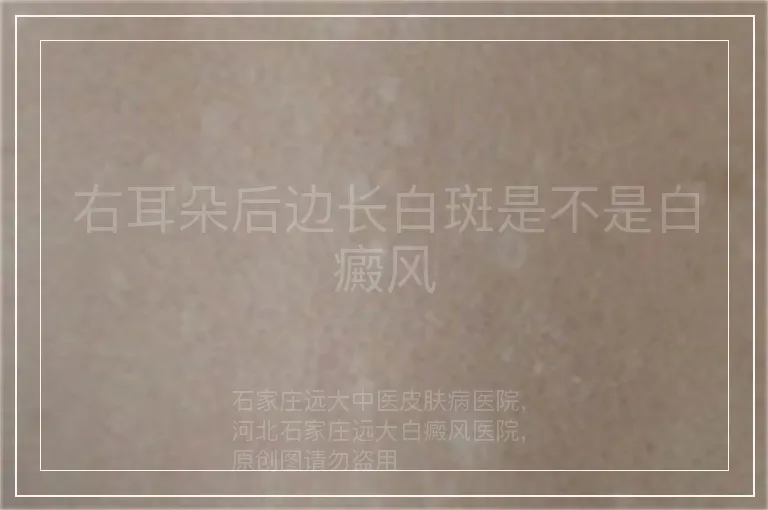 右耳朵后边长白斑是不是白癜风