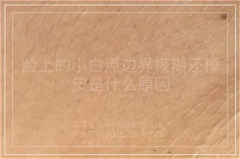 脸上的小白点边界模糊还掉皮是什么原因