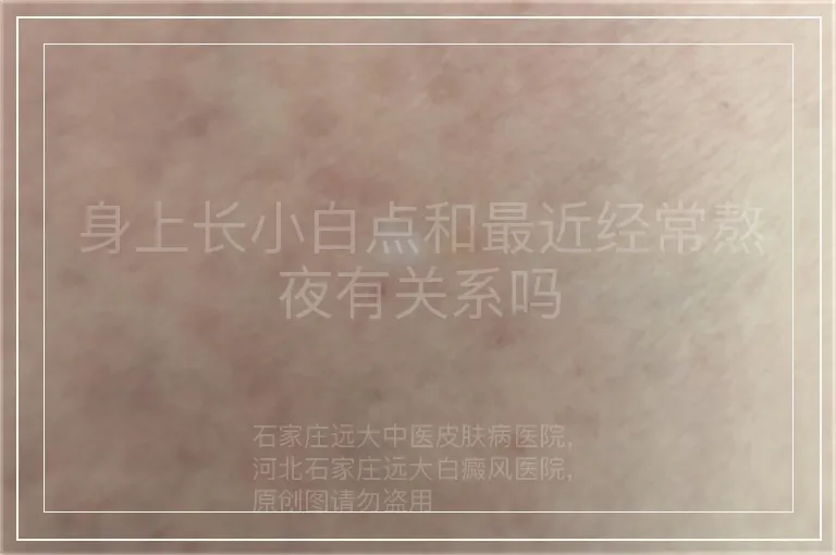 身上长小白点和最近经常熬夜有关系吗