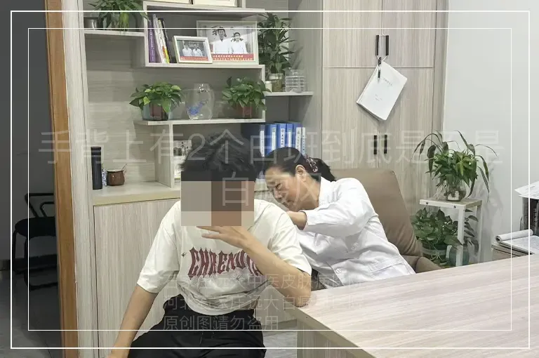 手背上有2个白斑到底是不是白癜风