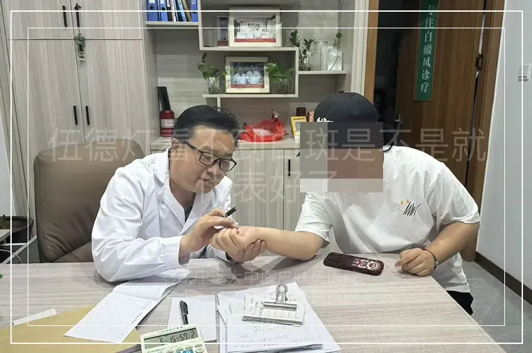 伍德灯看不到白斑是不是就代表好了