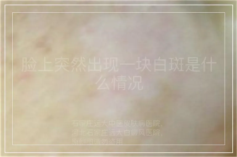 脸上突然出现一块白斑是什么情况