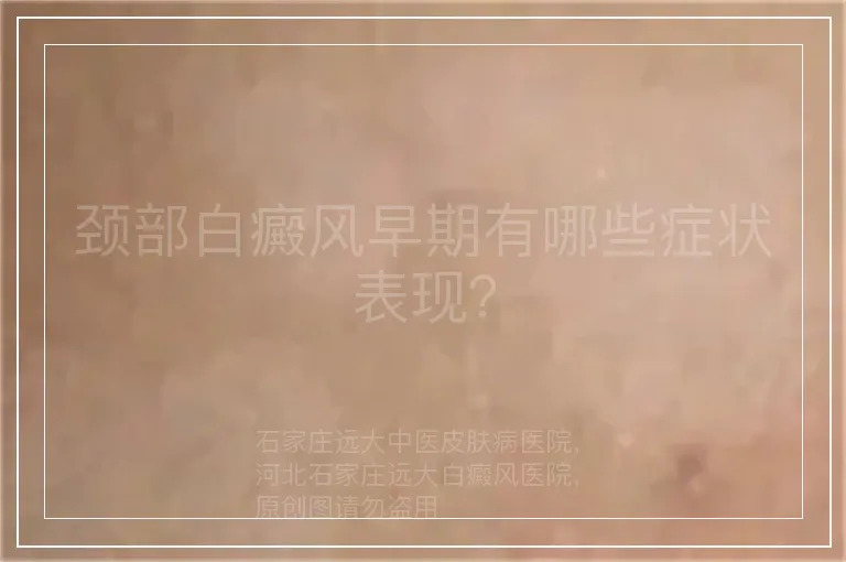 颈部白癜风早期有哪些症状表现？