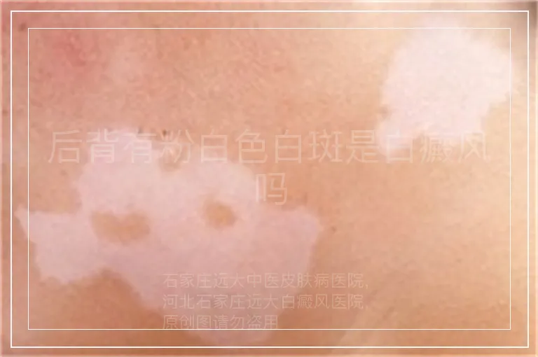 后背有粉白色白斑是白癜风吗