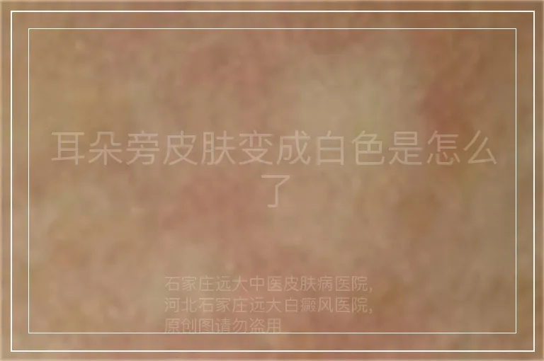 耳朵旁皮肤变成白色是怎么了