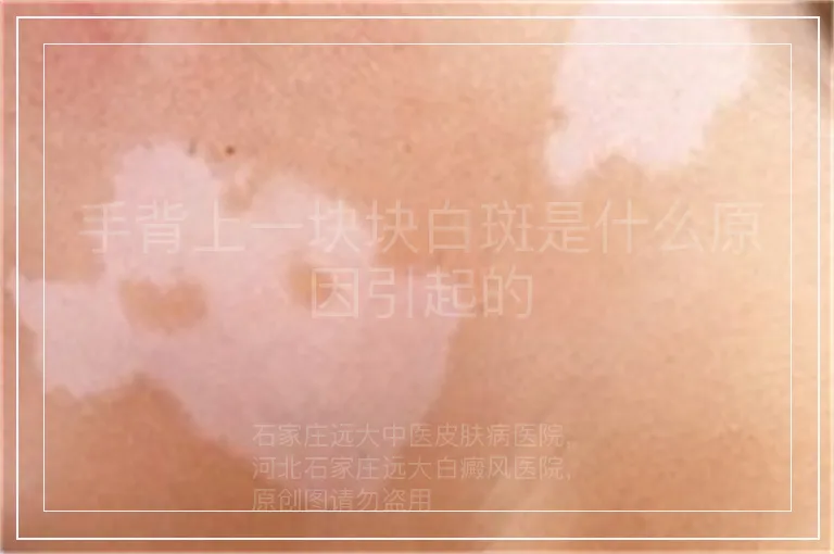 手背上一块块白斑是什么原因引起的