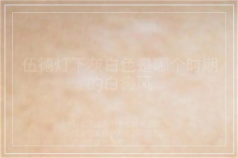 伍德灯下灰白色是哪个时期的白癜风