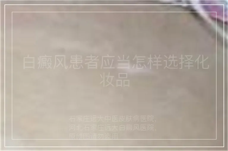 白癜风患者应当怎样选择化妆品