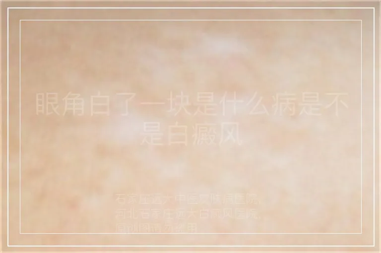 眼角白了一块是什么病是不是白癜风