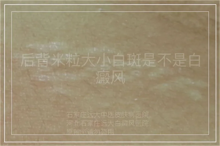 后背米粒大小白斑是不是白癜风
