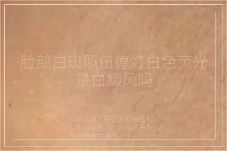 脸部白斑照伍德灯白色荧光是白癜风吗