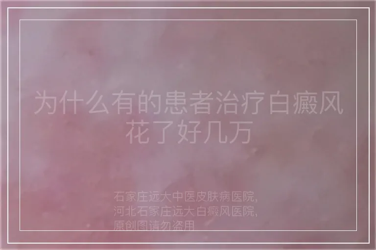 为什么有的患者治疗白癜风花了好几万