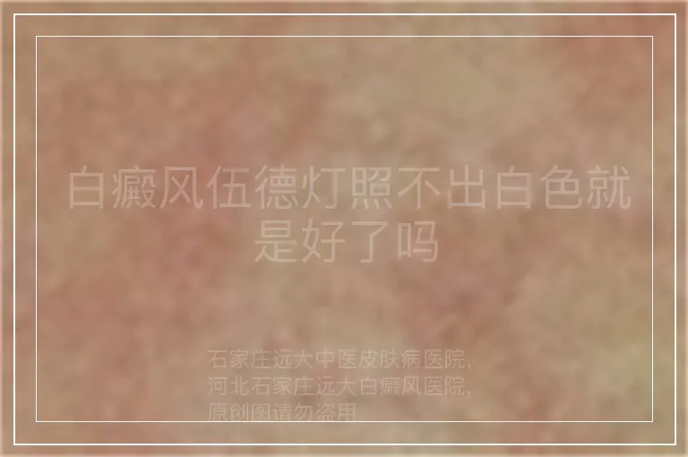 白癜风伍德灯照不出白色就是好了吗