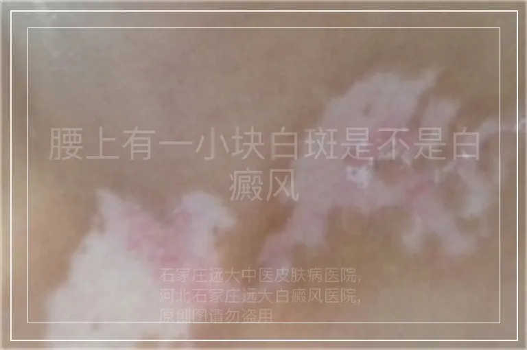 腰上有一小块白斑是不是白癜风