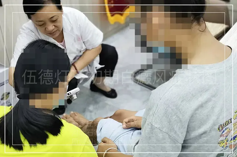 伍德灯下初期白癜风症状图