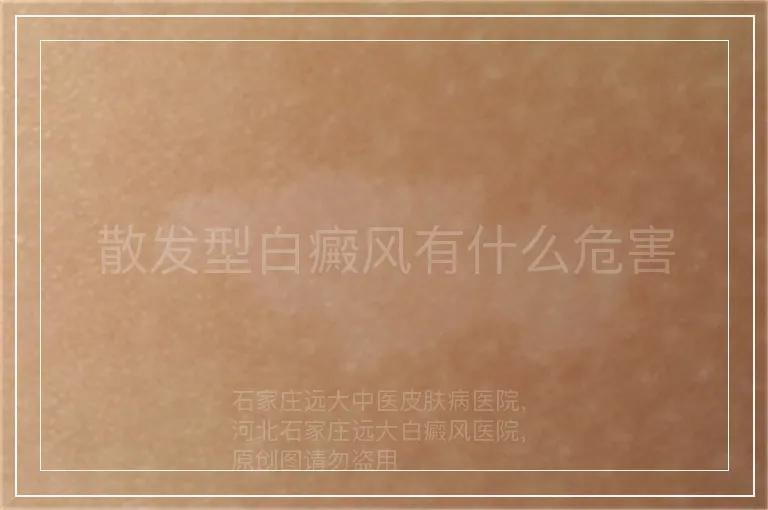 散发型白癜风有什么危害