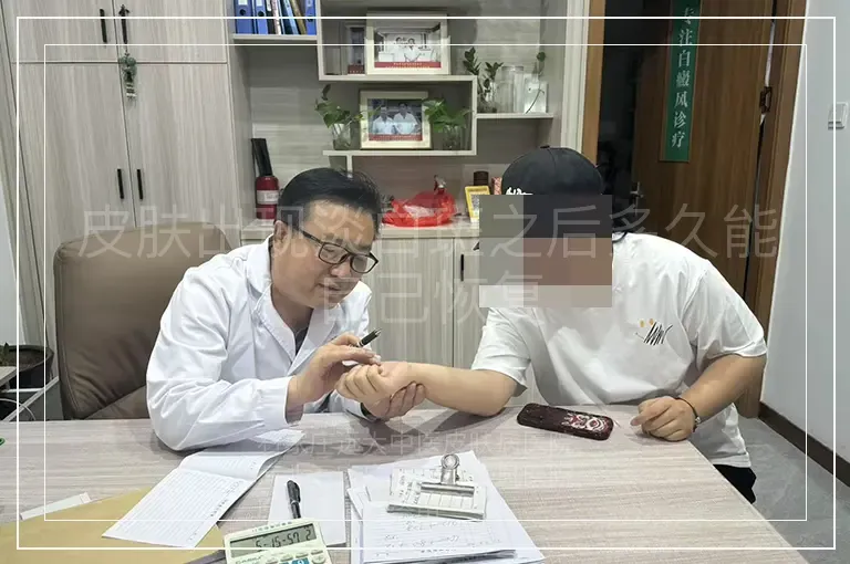皮肤出现淡白斑之后多久能自己恢复