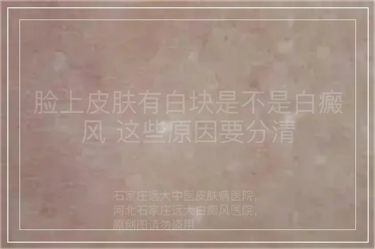 脸上皮肤有白块是不是白癜风 这些原因要分清