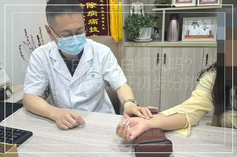 脸上有白块是白癜风吗？教你从外观特征初步分辨