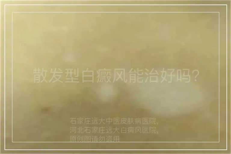 散发型白癜风能治好吗？