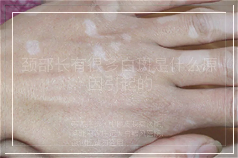 颈部长有很多白斑是什么原因引起的