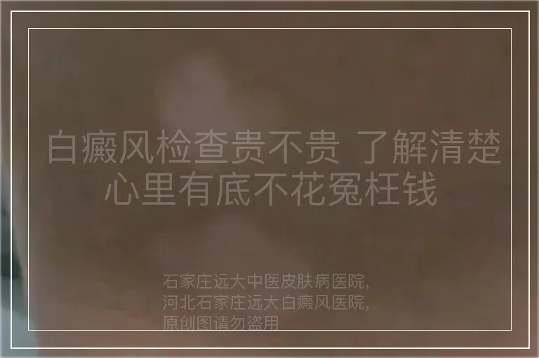 白癜风检查贵不贵 了解清楚心里有底不花冤枉钱