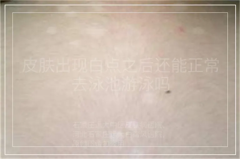 皮肤出现白点之后还能正常去泳池游泳吗