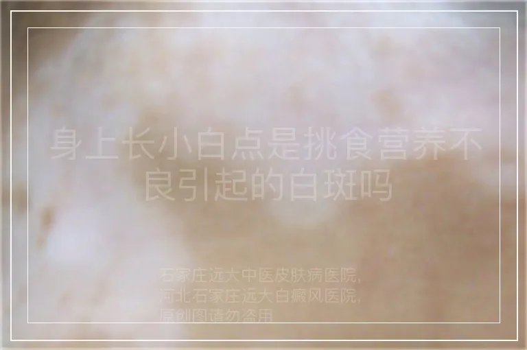 身上长小白点是挑食营养不良引起的白斑吗
