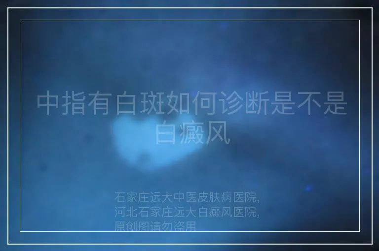 中指有白斑如何诊断是不是白癜风