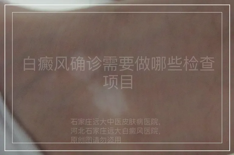 白癜风确诊需要做哪些检查项目
