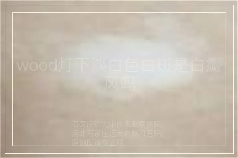wood灯下淡白色白斑是白癜风吗