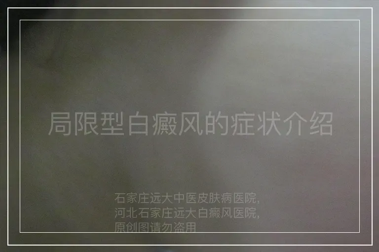局限型白癜风的症状介绍