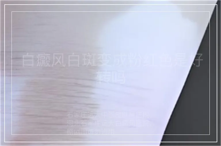 白癜风白斑变成粉红色是好转吗
