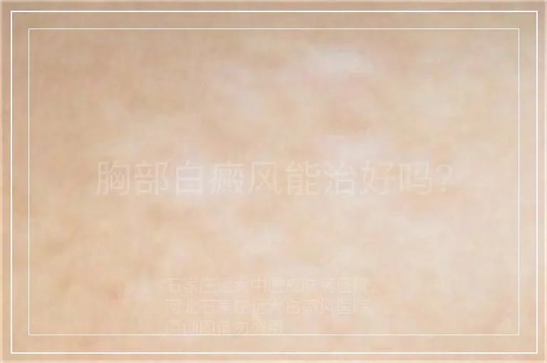 胸部白癜风能治好吗？