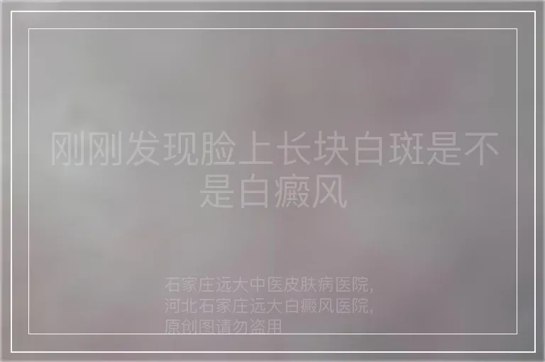 刚刚发现脸上长块白斑是不是白癜风