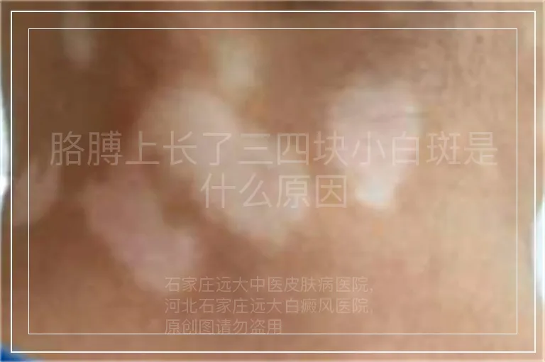 胳膊上长了三四块小白斑是什么原因