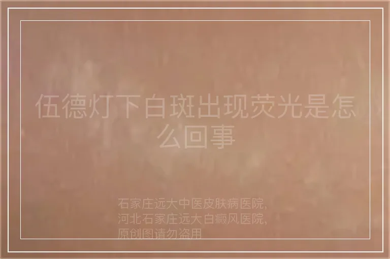 伍德灯下白斑出现荧光是怎么回事